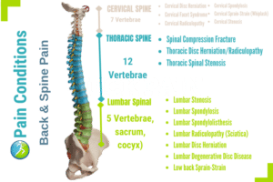 Herniated Disk Spine Dr Pain Clinic In MA 02379