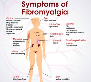 Fibromyalgia | Best Chroinc Pain Dr 02379