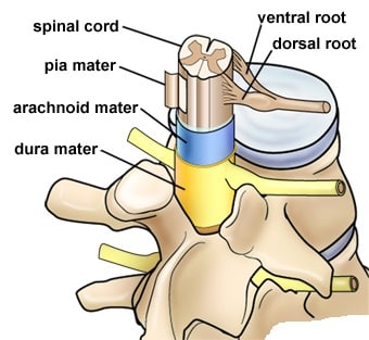 Implanted Devices SCS | Spine Procedure | Pain Clinic 02379