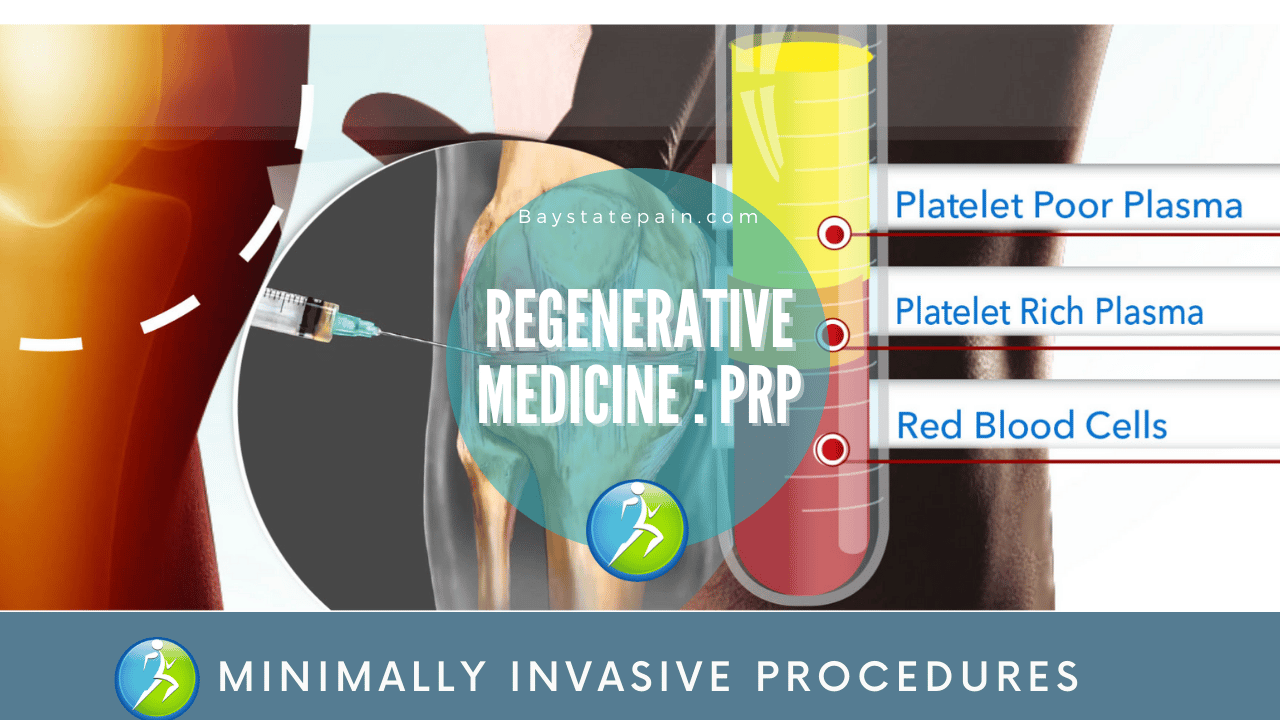 Regenerative Medicine | 3 Effective Evidence-Based Treatment